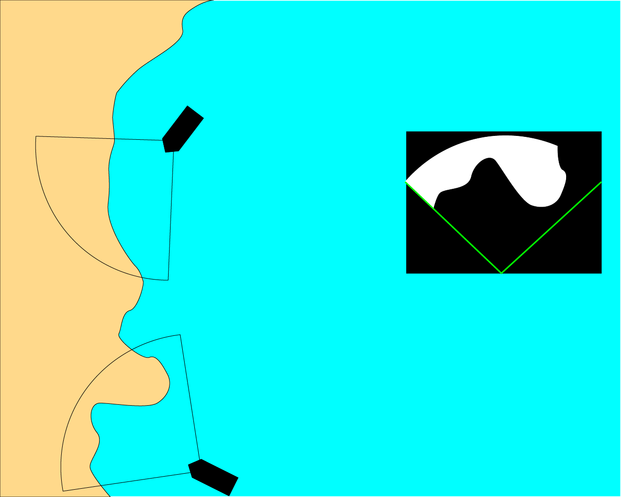 GNSS spoofing detection with radar